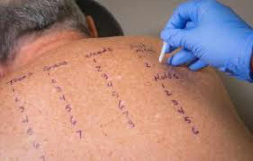 Before You Try Another Allergy Medication, Read This Guide to Allergy Testing Near Me