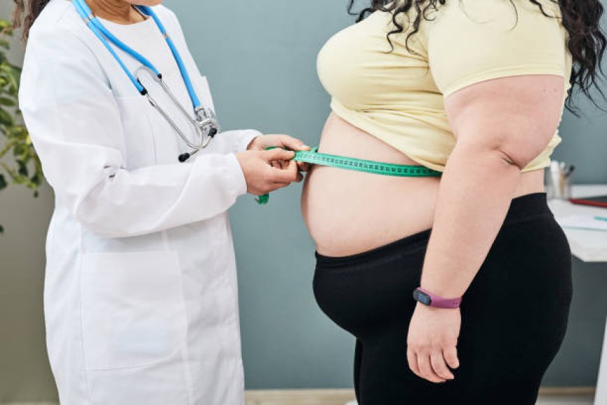 How to Choose the Best Obesity Treatment Dubai Program for Your Needs