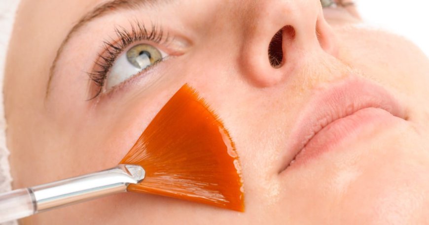 How Does a Salicylic Acid Peel Benefit the Skin?