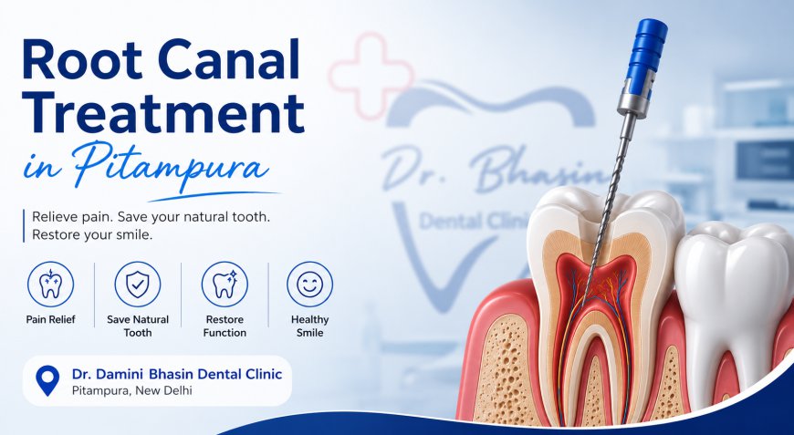 7 Benefits of Root Canal Treatment in Pitampura
