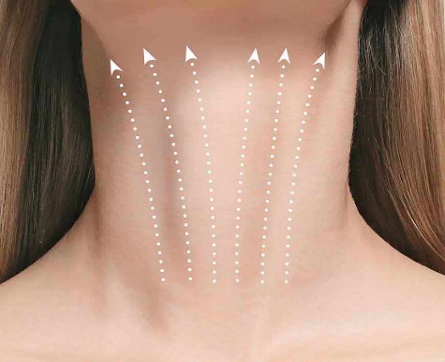 How Is Neck Lift Surgery Performed?
