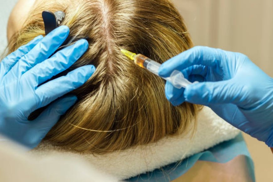 Exosome Hair in Dubai: A Patient’s Guide to Follicle Regeneration
