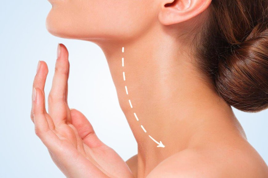 Who Is an Ideal Candidate for Neck Lift Surgery?
