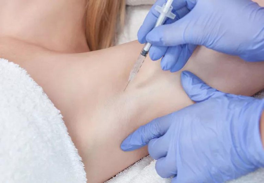 Can Botox Reduce Excessive Sweating?