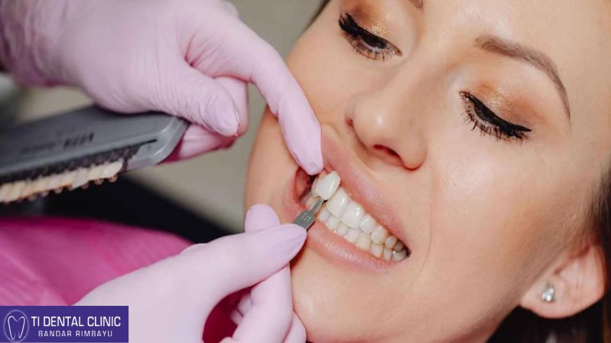 Clear Aligners for Kids: A Discreet Solution to Straighten Teeth
