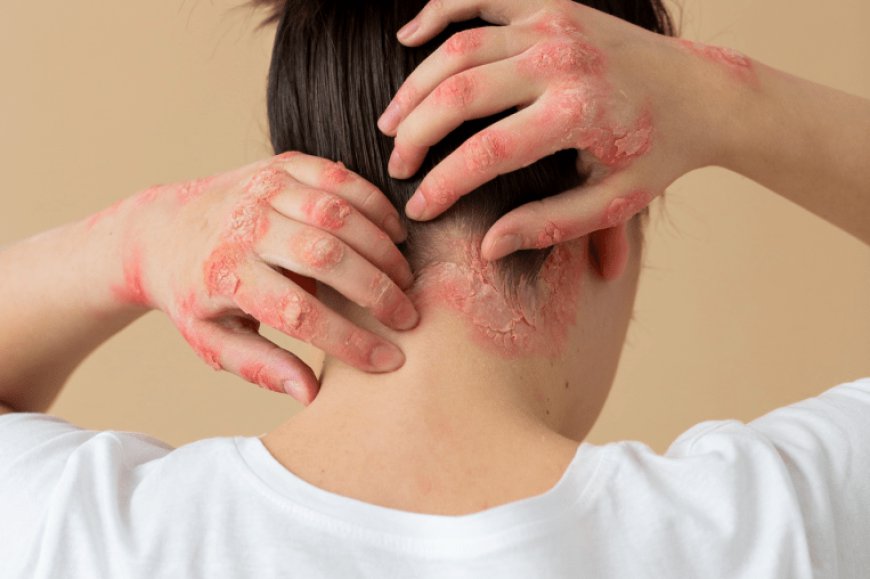 Can Skin Conditions Be Treated Successfully?