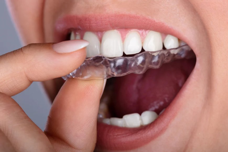 How Do Mouth Guards Help Protect Teeth?