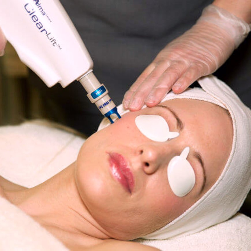 Is ClearLift Laser Effective for Younger-Looking Skin?