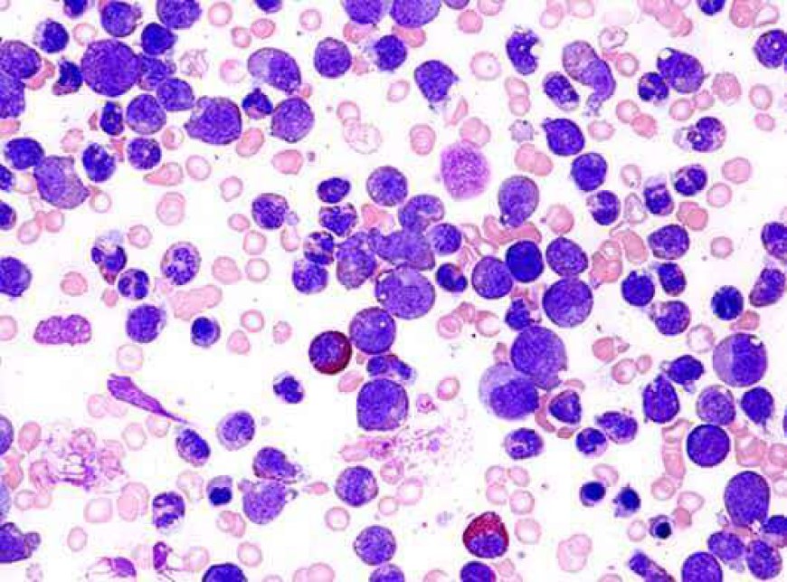Chemotherapy Induced Neutropenia Market Size, Trends, and Growth Outlook 2026-2033