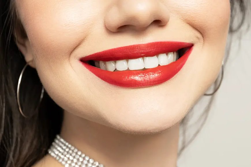 How Is Hollywood Smile Design Performed?