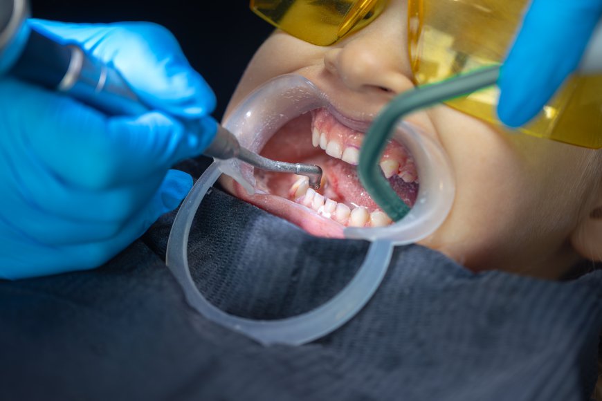 Wisdom Tooth Extraction Healing Stages Pictures: What to Expect Every Day