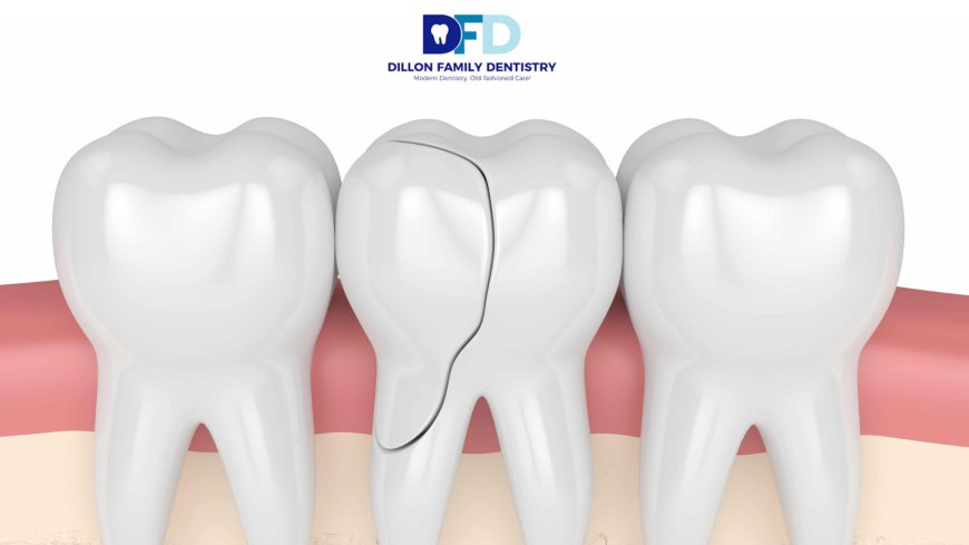 Cracked Tooth Emergency? What To Do | Dentist Bryn Mawr