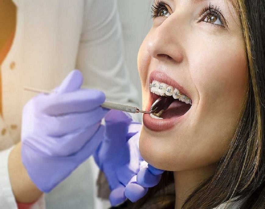 Walk-In Dentist Fort Worth | Dental Implants, Teeth Whitening & Dental Cleaning at Prestige Dental