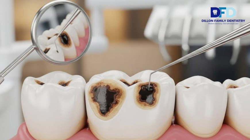 Black Spot on Tooth? Bryn Mawr Family Dentist Explains