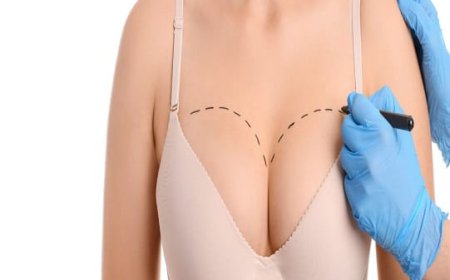 What Are the Key Advantages of a Breast Lift?