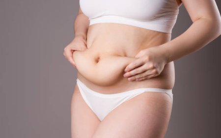 Top Reasons to Choose Tummy Tuck in Dubai This Year
