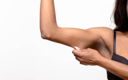 Top Arm Lift Surgery in Dubai for Lasting Arm Results