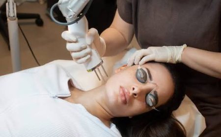 Pico Laser Treatment for Acne Scars: Does It Work?
