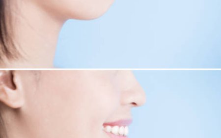 Top Chin Augmentation in Dubai for Lasting Results