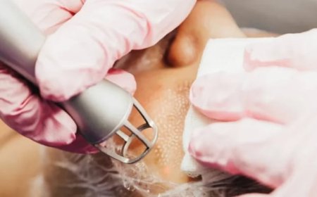 Fractional CO2 Laser Treatment Guide