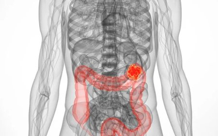 Metastatic Colorectal Cancer Market Size, Trends, Growth, and Forecast 2026-2032