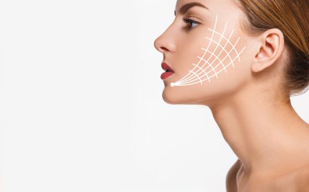 Is Thread Lift Treatment Considered Safe?