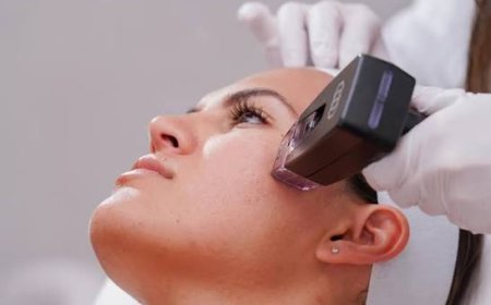 Morpheus8 for Stretch Marks: Is It Effective?