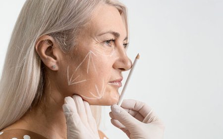 How Is a Facelift Procedure Performed?