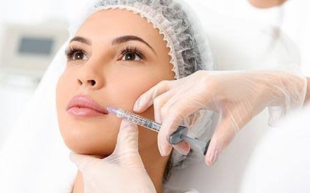 Juvederm Filler Myths vs Facts You Should Know