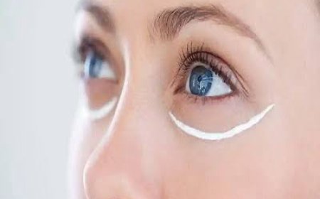 How Does Eye Bag Removal Treatment Work?
