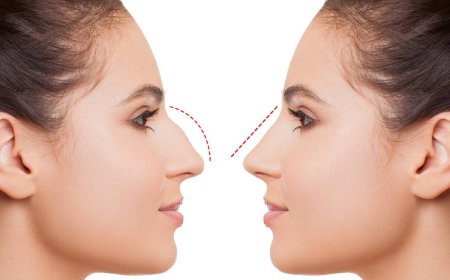 The Role of Facial Proportion Analysis in Successful Rhinoplasty Results