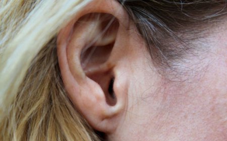Top Earlobe Surgery in Dubai Benefits for Earring Wear