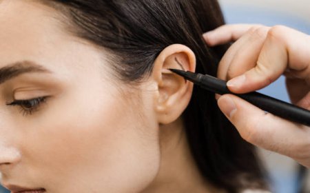 How Ear Reshaping | Otoplasty Dubai Creates Natural Results