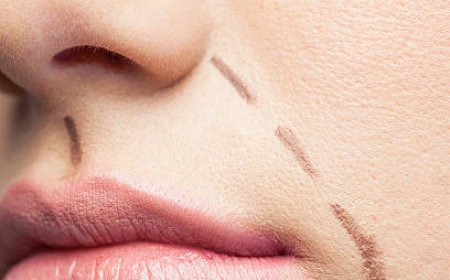 How Facial Scar Revision in Dubai Restores Smooth Skin