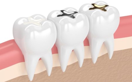 Best Teeth Filling Solutions with Trusted Dental Tourism by Meditouring