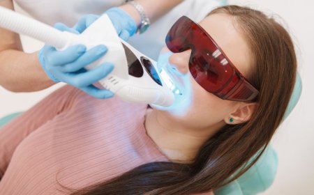 7 Proven Tips on How to Whiten Teeth Quickly