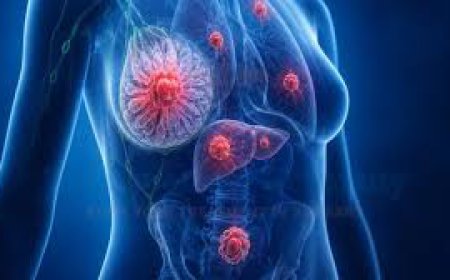 Global Triple Negative Breast Cancer (TNBC) Treatment Market Size and Growth Forecast