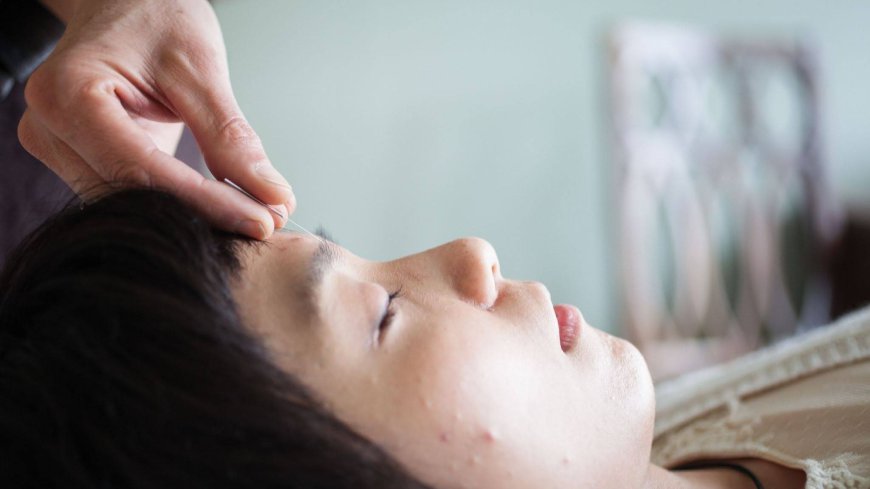 First Cosmetic Acupuncture Session in Oakland: What to Know