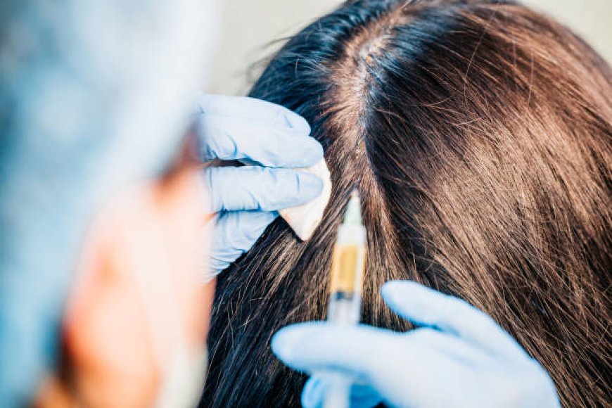 How Exosome Hair in Dubai Helps Stop Hair Thinning Fast