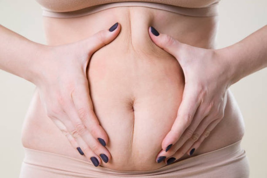 Best Mommy Makeover in Dubai for Lasting Body Results