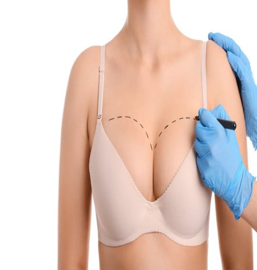 What Are the Key Advantages of a Breast Lift?