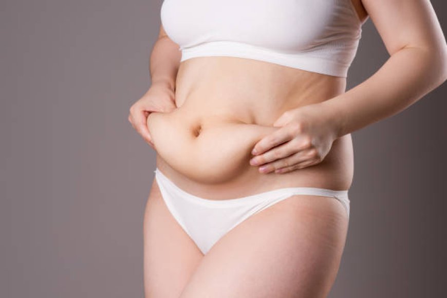Top Reasons to Choose Tummy Tuck in Dubai This Year