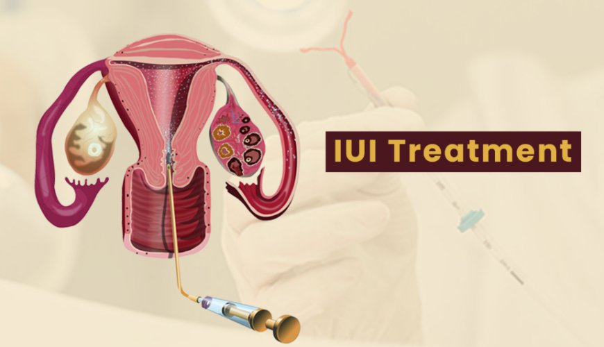 Best IUI Treatment in Vikaspuri: Complete Guide