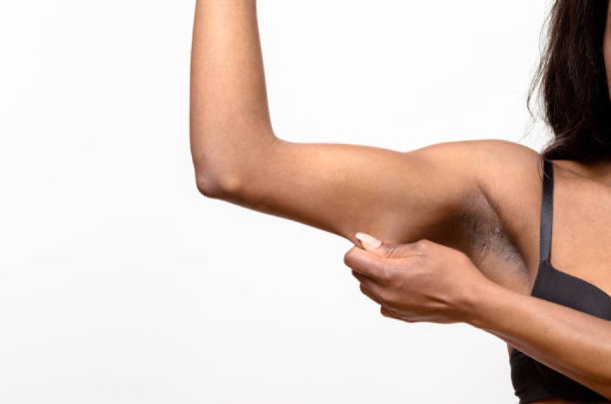 Top Arm Lift Surgery in Dubai for Lasting Arm Results