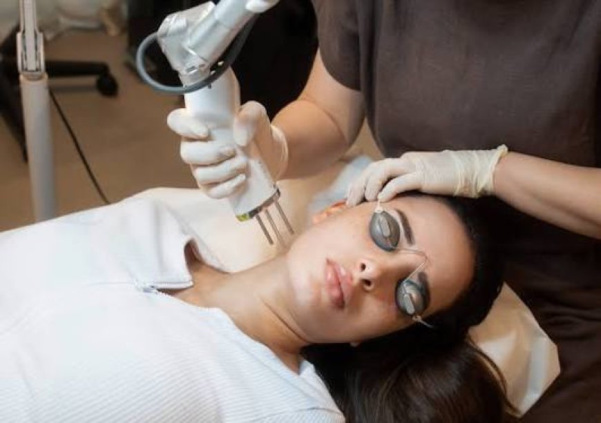 Pico Laser Treatment for Acne Scars: Does It Work?
