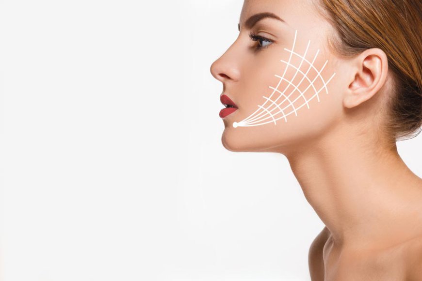 Is Thread Lift Treatment Considered Safe?