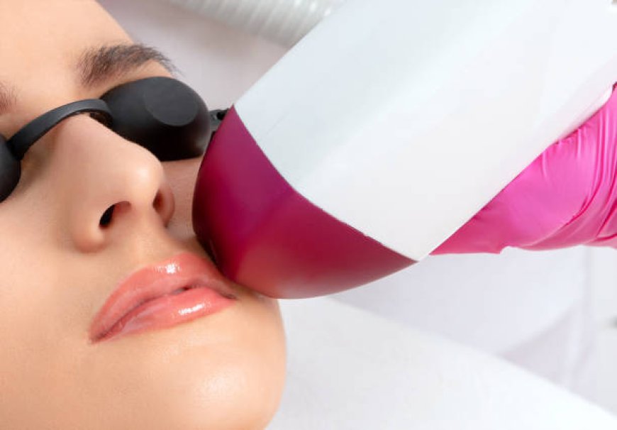 The Complete Guide to IPL Photofacial Treatments Near Boston