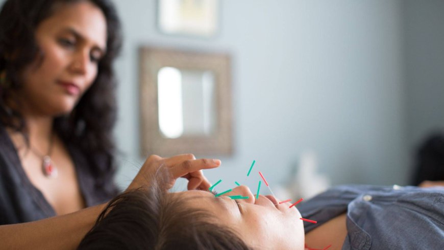 Facial Acupuncture for Acne & Rosacea in Oakland