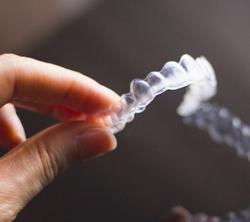 Common Questions About Clear Braces on Teeth
