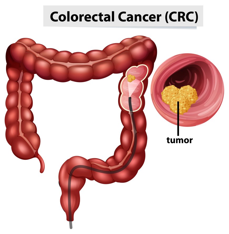 U.S. Colorectal Cancer Screening Market Size, Trends, and Growth Forecast